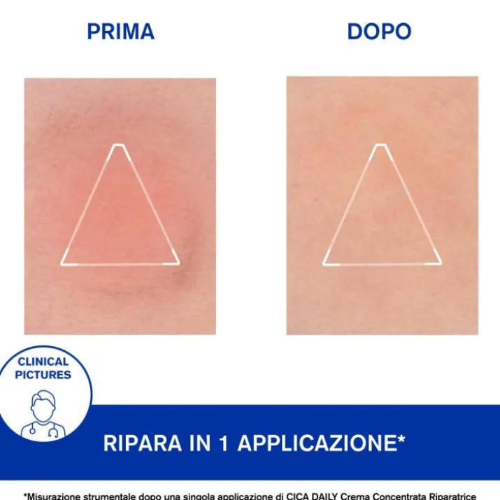 Bariéderm-Cica Daily Uriage 30ml