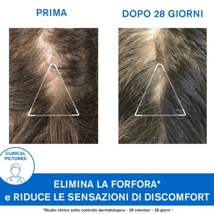 DS Hair Shampoo Trattamento Antiforfora Uriage 200ml