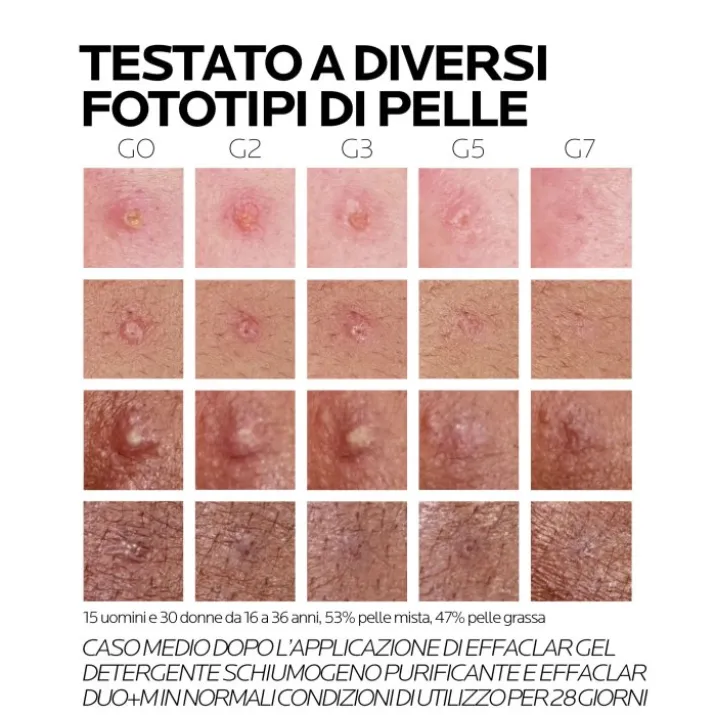 Effaclar Duo +M La Roche-Posay 40ml