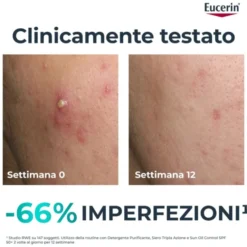 EUCERIN DC SIERO TRIPLA AZ40ML