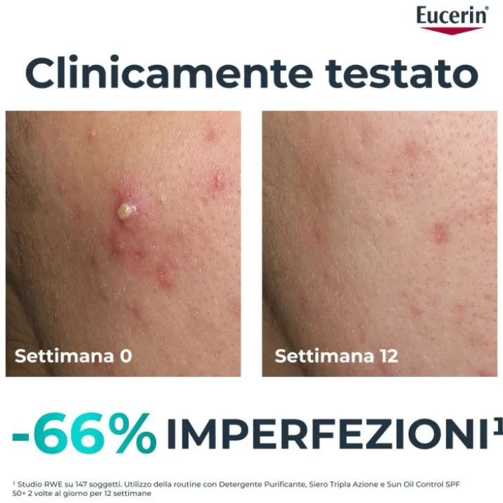 EUCERIN DC SIERO TRIPLA AZ40ML