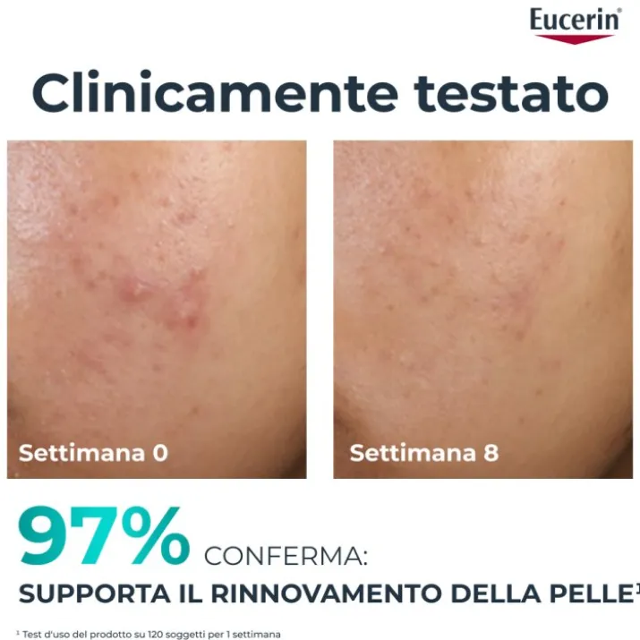 EUCERIN DC TRATTAMENTO RINN