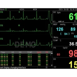 P16 MONITOR MULTIPARAM PC3000