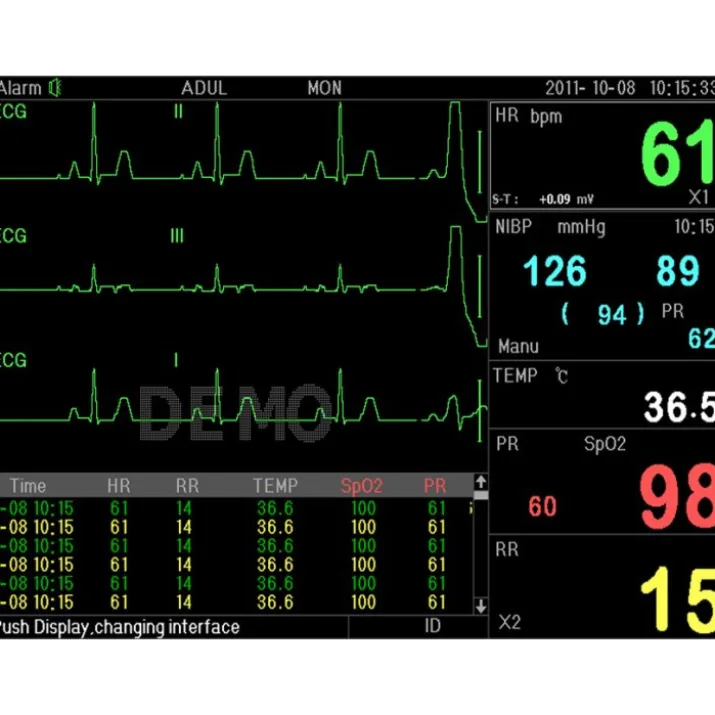 P16 MONITOR MULTIPARAM PC3000