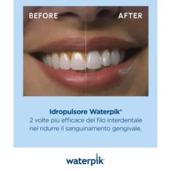 Waterpik Cordless Plus WF-21 Enhance Idropulsore Portatile